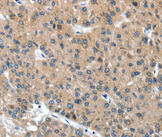 DSC1 Polyclonal Antibody (E-AB-13193)