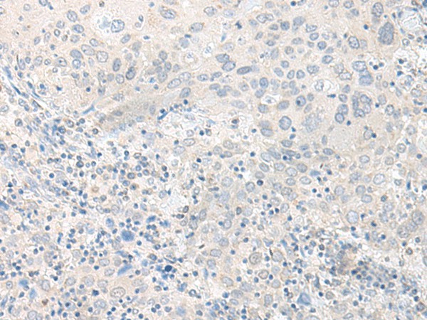 TIMM8A Polyclonal Antibody (E-AB-18755)