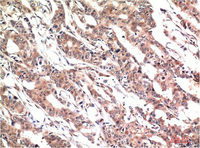 Phospho-STAT3 (Tyr705) Monoclonal Antibody (E-AB-51040)
