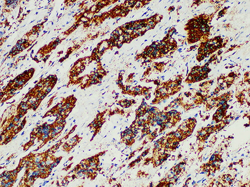 ACTH Monoclonal Antibody (ELAB6001-M)