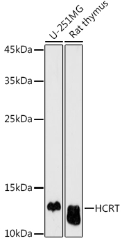 HCRT Polyclonal Antibody (E-AB-92990)
