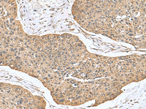 CSRP2 Polyclonal Antibody (E-AB-53072)