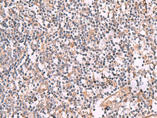 SLC12A5 Polyclonal Antibody (E-AB-52074)