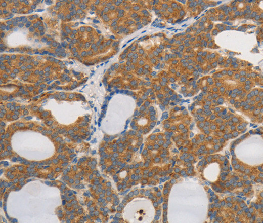 PPP2CB Polyclonal Antibody (E-AB-16036)
