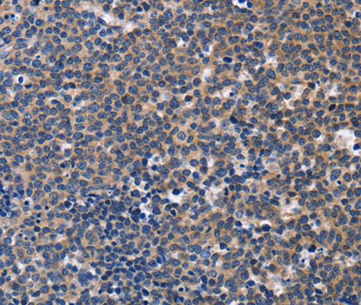 CCR6 Polyclonal Antibody (E-AB-16307)