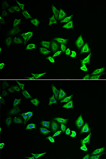 MYOZ2 Polyclonal Antibody (E-AB-61986)