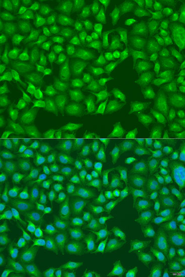 MERTK Polyclonal Antibody (E-AB-60965)