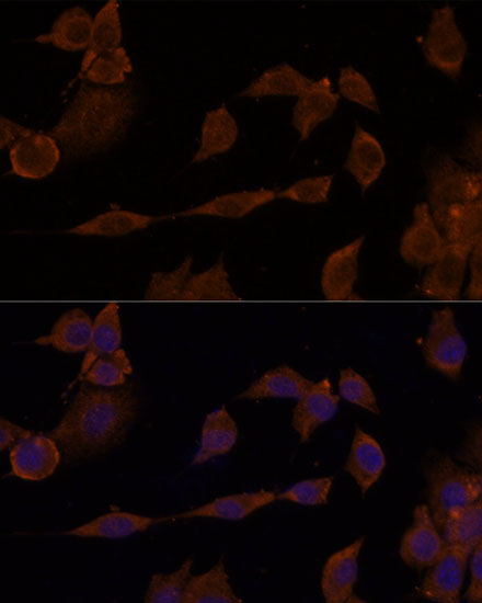 GNA11 Polyclonal Antibody (E-AB-92147)