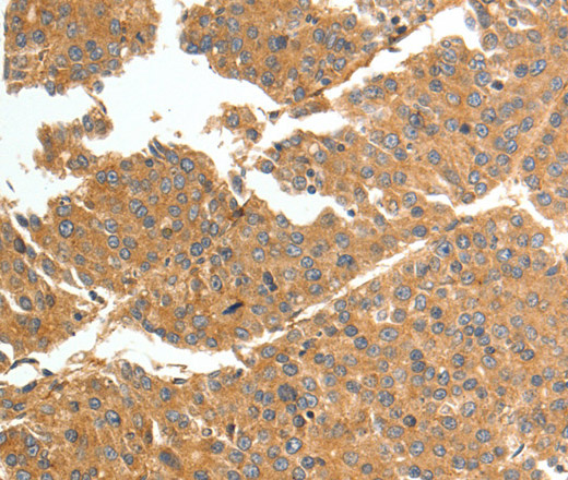TNN Polyclonal Antibody (E-AB-16087)