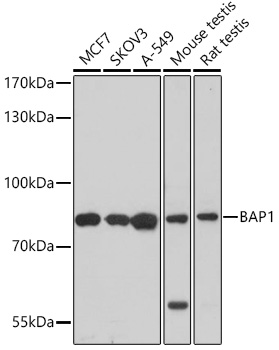 BAP1 Polyclonal Antibody (E-AB-67774)