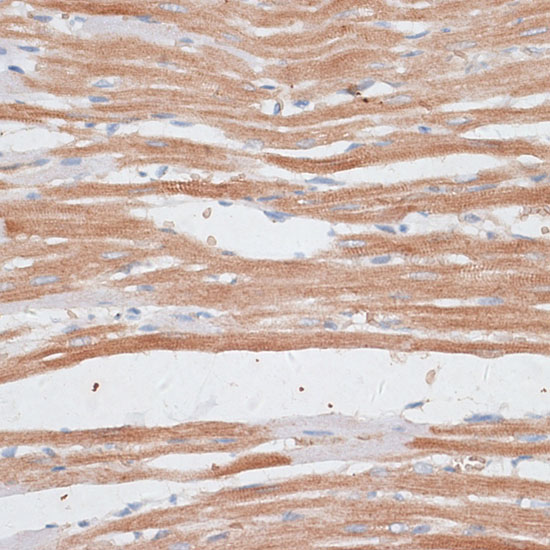 KATNA1 Polyclonal Antibody (E-AB-66832)