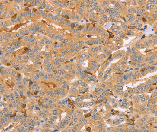 CCL16 Polyclonal Antibody (E-AB-13114)