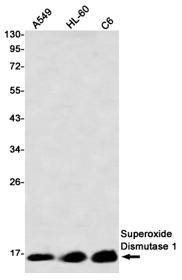 Recombinant Superoxide Dismutase 1 Monoclonal Antibody (E-AB-81608)