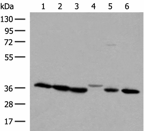 LDHA Polyclonal Antibody (E-AB-18030)