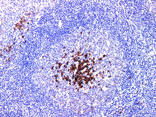 CD38 Monoclonal Antibody (ELAB6153-M)