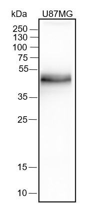 Recombinant PD-L1 Monoclonal Antibody (AN301623L)