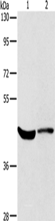 KCNA7 Polyclonal Antibody (E-AB-13352)