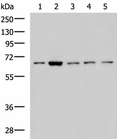 CHEK2 Polyclonal Antibody (E-AB-53245)