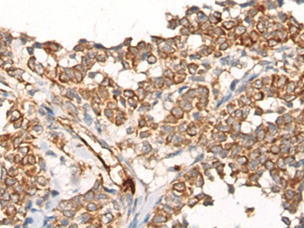 CA5B Polyclonal Antibody (E-AB-17756)