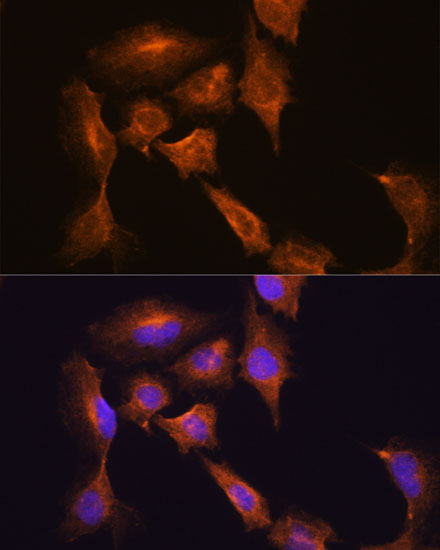 HOOK3 Polyclonal Antibody (E-AB-65353)