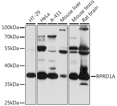 RPRD1A Polyclonal Antibody (E-AB-91315)