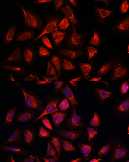 NDUFA4L2 Polyclonal Antibody (E-AB-64972)