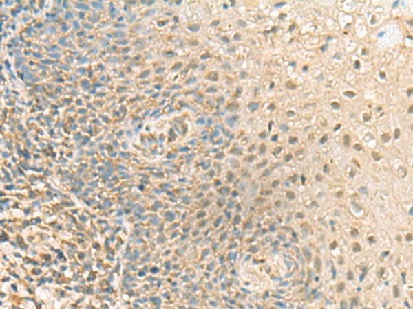 PPCDC Polyclonal Antibody (E-AB-18796)
