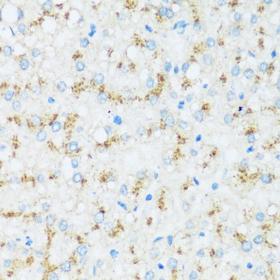 APOD Polyclonal Antibody (E-AB-66929)