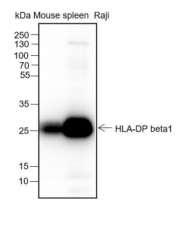 Recombinant HLA-DPB1 Monoclonal Antibody (AN301551L)