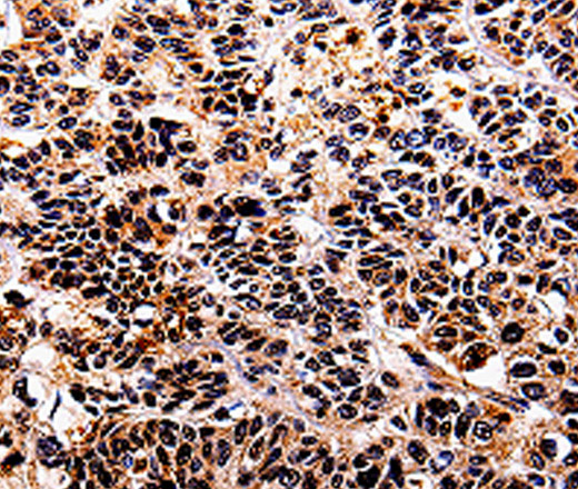 IL10RA Polyclonal Antibody (E-AB-10098)