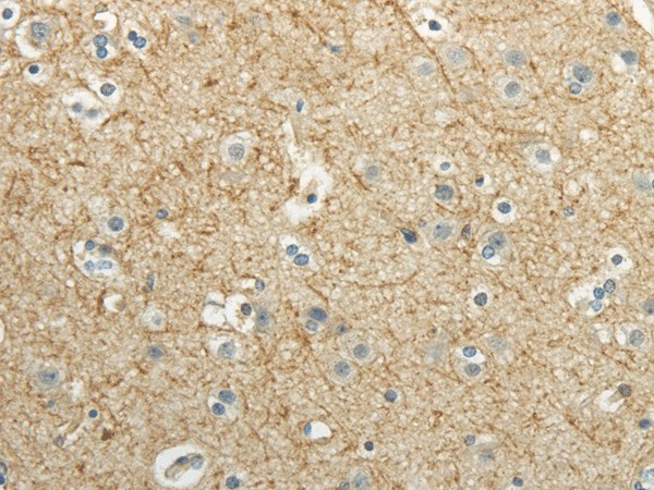 WNT2 Polyclonal Antibody (E-AB-17610)