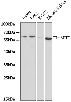 MITF Polyclonal Antibody (E-AB-60287)