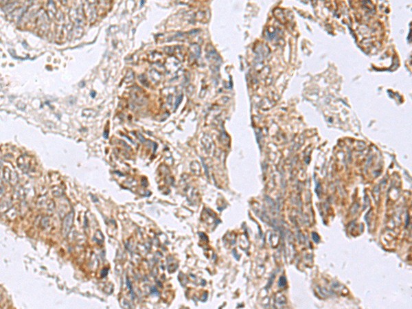 RTKN2 Polyclonal Antibody (E-AB-18983)