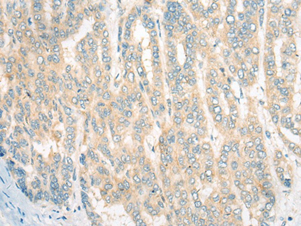 CDKAL1 Polyclonal Antibody (E-AB-52531)