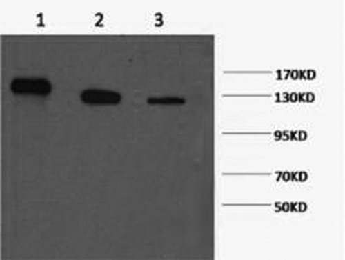 PARP1 Monoclonal Antibody (E-AB-22073)