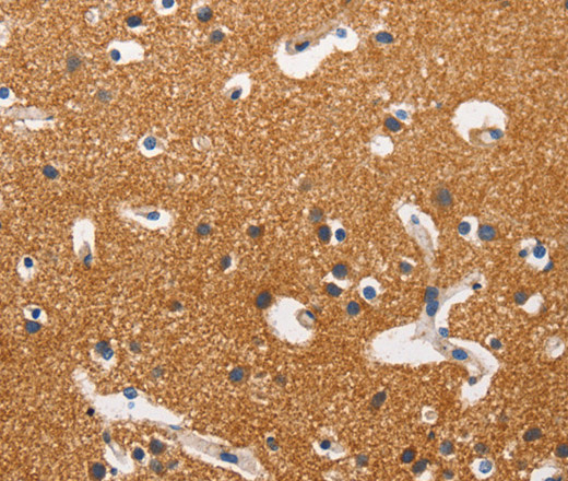 HK2 Polyclonal Antibody (E-AB-10929)