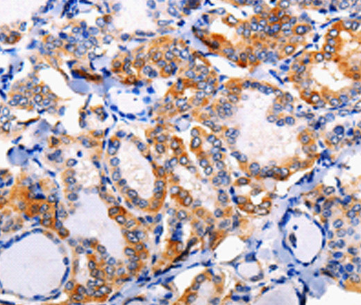 AP1B1 Polyclonal Antibody (E-AB-15476)