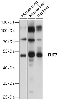 FUT7 Polyclonal Antibody (E-AB-92957)