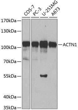 ACTN1 Polyclonal Antibody (E-AB-60220)