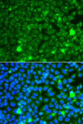 GBA3 Polyclonal Antibody (E-AB-63153)