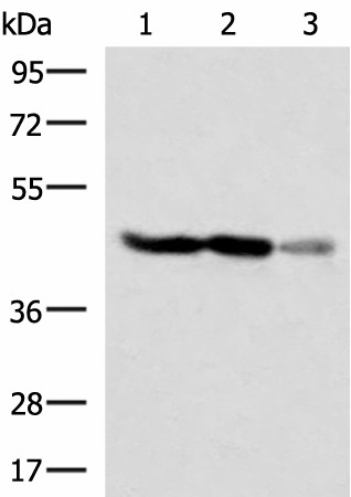 FDFT1 Polyclonal Antibody (E-AB-52940)