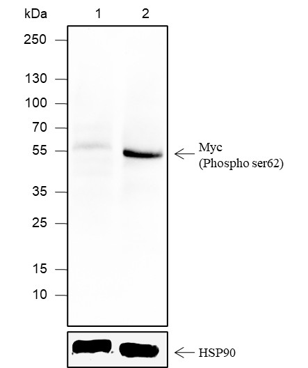 Recombinant Phospho-c-Myc (Ser62) Monoclonal Antibody (AN302092L)