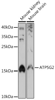 ATP5G2 Polyclonal Antibody (E-AB-92011)