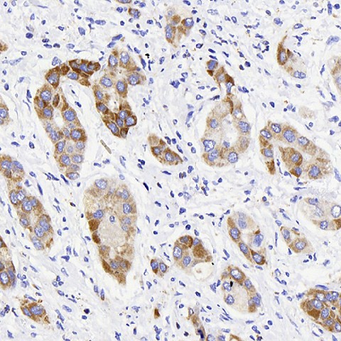 ATG5 Polyclonal Antibody (E-AB-70289)