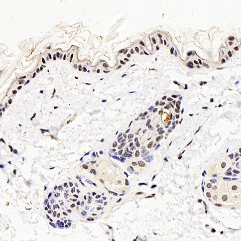 MGMT Polyclonal Antibody (E-AB-70262)
