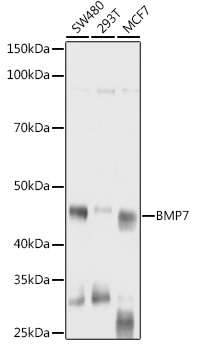 BMP7 Polyclonal Antibody (E-AB-90023)