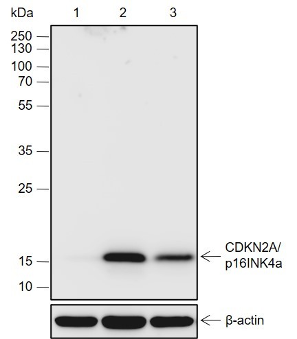 Recombinant CDKN2A/p16INK4a Monoclonal Antibody (AN301991L)