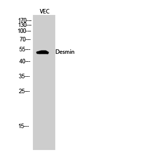 Desmin Polyclonal Antibody (E-AB-31185)