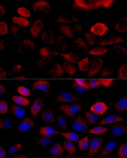 FGFR2 Polyclonal Antibody (E-AB-60590)
