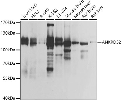 ANKRD52 Polyclonal Antibody (E-AB-93296)